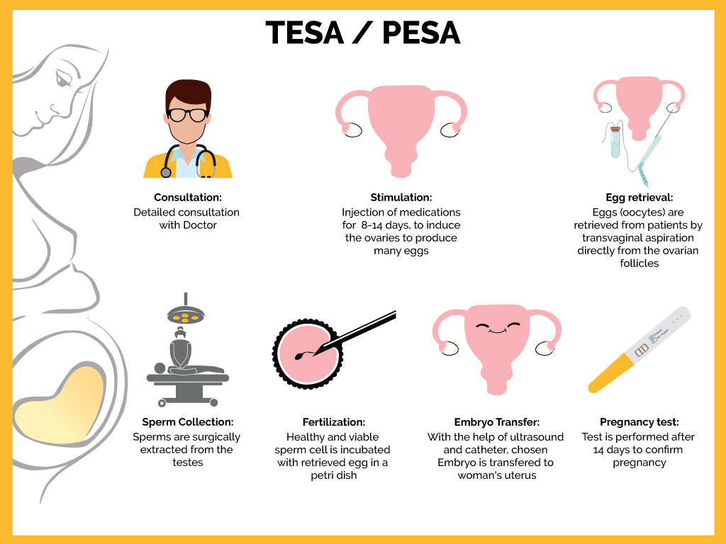 Dream Flower IVF Centre|Best Infertility treatment centre in South India - PESA, TESA, TESE, MESA and micro-TESE
